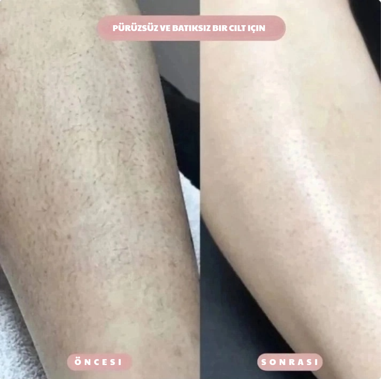 VibeCut Çift Taraflı Tıraş Makinesi